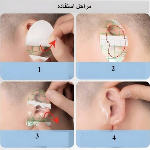 چسب گوش بهداشتی نوزاد مدل EL بسته ۲۰ عددی - تصویر 3